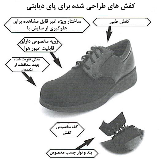 تصویر کفش دیابتی